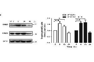 IFN-γ increased rates of autophagy in primary BMECs in vitro. (RTN4RL2 anticorps  (AA 241-337))