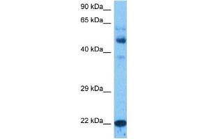 Host:  Rabbit  Target Name:  NTM1A  Sample Tissue:  Large Intestine Tumor lysates  Antibody Dilution:  1ug/ml (METTL11A anticorps  (N-Term))