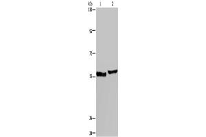 Western Blotting (WB) image for anti-Solute Carrier Family 1 (High Affinity Aspartate/glutamate Transporter), Member 6 (SLC1A6) antibody (ABIN2431275) (SLC1A6 anticorps)