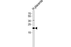 Western Blotting (WB) image for anti-Chromosome 2 Open Reading Frame 74 (C2ORF74) antibody (ABIN3004714) (C2ORF74 anticorps)