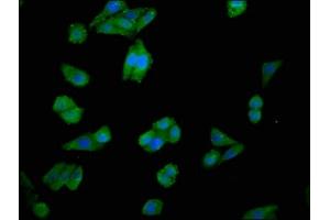 Immunofluorescence staining of HepG2 cells with ABIN7147616 at 1:100, counter-stained with DAPI. (Choline Kinase alpha anticorps  (AA 79-173))
