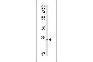 Western blot analysis of PRL3 Antibody (ABIN392854 and ABIN2842272) in mouse heart tissue lysates (35 μg/lane).