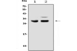 Western blot analysis of PDCD10 using anti-PDCD10 antibody (ABIN5693304).