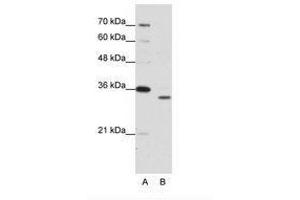 Image no. 1 for anti-Proteasome Subunit alpha Type 1 (PSMA1) (N-Term) antibody (ABIN203038) (PSMA1 anticorps  (N-Term))