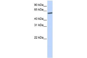 SENP3 anticorps  (N-Term)