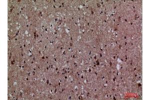 Immunohistochemistry (IHC) analysis of paraffin-embedded Human Brain, antibody was diluted at 1:100.