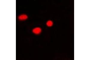 Immunofluorescent analysis of PSMB10 staining in Hela cells. (PSMB10 anticorps)