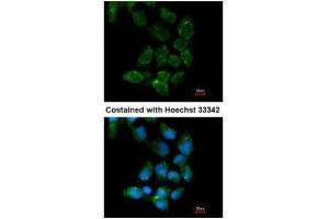 ICC/IF Image Immunofluorescence analysis of paraformaldehyde-fixed A431, using USP15, antibody at 1:200 dilution. (USP15 anticorps  (C-Term))