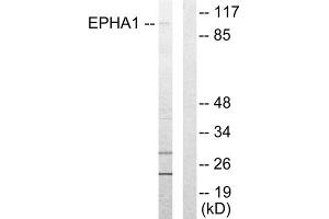 Western blot analysis of extracts from COLO205 cells, using EPHA1 antibody. (EPHA1 anticorps  (Internal Region))