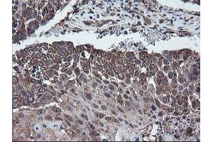 Image no. 10 for anti-Diphthamide Biosynthesis Protein 2 (DPH2) antibody (ABIN1497893) (DPH2 anticorps)