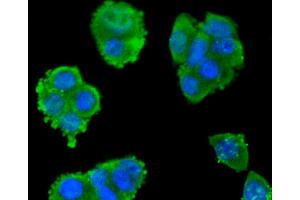 SW480 cells were fixed in paraformaldehyde, permeabilized with 0.