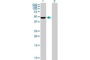 Western Blot analysis of UCKL1 expression in transfected 293T cell line by UCKL1 MaxPab polyclonal antibody. (UCKL1 anticorps  (AA 1-419))