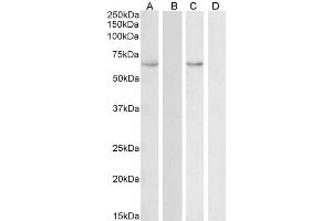 ABIN1590134 (0. (HSPA13 anticorps  (AA 83-95))