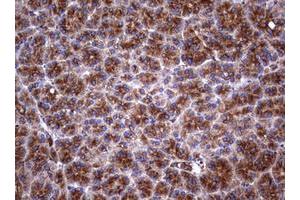 Image no. 20 for anti-Tumor Necrosis Factor Receptor Superfamily, Member 8 (TNFRSF8) (AA 19-379) antibody (ABIN1491084)