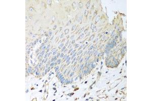 Immunohistochemistry of paraffin-embedded human esophagus using SGCB antibody at dilution of 1:100 (40x lens). (SGCB anticorps)