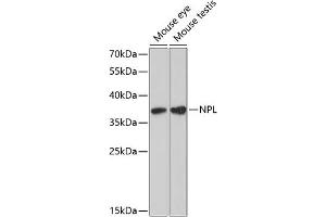 Western blot analysis of extracts of various cell lines, using NPL antibody (ABIN6132931, ABIN6144778, ABIN6144779 and ABIN6224929) at 1:3000 dilution. (NPL anticorps  (AA 1-250))