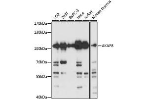 Western blot analysis of extracts of various cell lines, using  antibody (ABIN3017254, ABIN3017255, ABIN3017256 and ABIN6220015) at 1:3000 dilution.