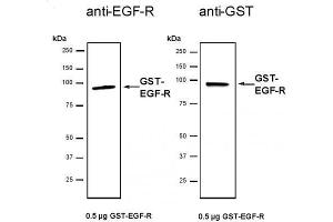 Recombinant EGFR protein tested by SDS-PAGE gel.