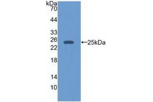 EBI3 anticorps  (AA 21-229)