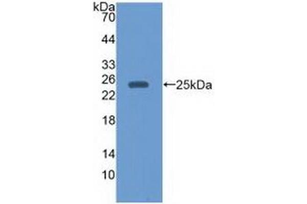 EBI3 抗体  (AA 21-229)