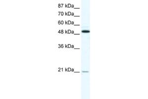 Western Blotting (WB) image for anti-Tumor Necrosis Factor Receptor Superfamily, Member 11b (TNFRSF11B) antibody (ABIN2463647) (Osteoprotegerin anticorps)