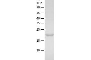 Western Blotting (WB) image for MAD2 Mitotic Arrest Deficient-Like 1 (Yeast) (MAD2L1) (AA 1-205) protein (His-IF2DI Tag) (ABIN7123825)