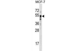Western Blotting (WB) image for anti-SET Domain Containing 8 Pseudogene 1 (SETD8P1) antibody (ABIN2996451) (SET7 anticorps)