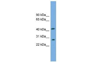 WB Suggested Anti-RABEPK Antibody Titration: 0. (RABEPK anticorps  (N-Term))