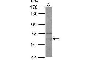 WB Image Sample (30 ug of whole cell lysate) A: U87-MG 7. (NARS anticorps)