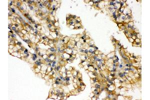 Anti- Aquaporin 2 Picoband antibody, IHC(P) IHC(P): Human Kidney Cancer Tissue