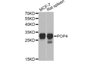 Western blot analysis of extracts of various cell lines, using POP4 Antibody. (RPP29 anticorps)