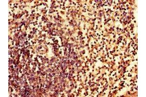 Immunohistochemistry of paraffin-embedded human spleen tissue using ABIN7156631 at dilution of 1:100