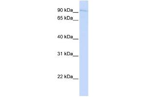 WB Suggested Anti-SYDE1 Antibody Titration:  0. (SYDE1 anticorps  (N-Term))