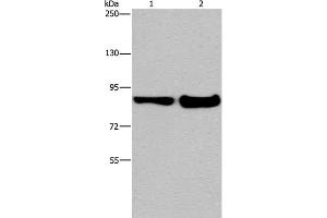 Western Blot analysis of Mouse lung and liver tissue using MAPRE3 Polyclonal Antibody at dilution of 1:1050 (MAPRE3 anticorps)