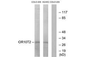 Western blot analysis of extracts from HuvEc/COLO cells, using OR10T2 Antibody.