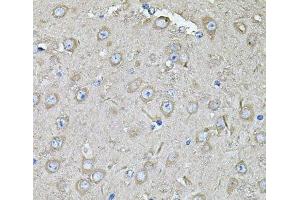 Immunohistochemistry of paraffin-embedded Mouse brain using EIF3C Polyclonal Antibody at dilution of 1:100 (40x lens).