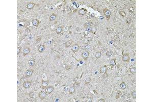 Immunohistochemistry of paraffin-embedded Mouse brain using EIF3C Polyclonal Antibody at dilution of 1:100 (40x lens). (EIF3C anticorps)