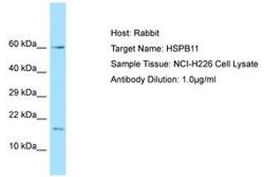 Image no. 1 for anti-Heat Shock Protein Family B (Small), Member 11 (HSPB11) (AA 6-55) antibody (ABIN6749885)