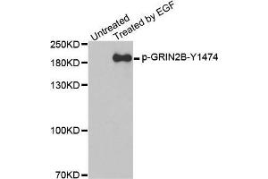 Western blot analysis of extracts from A431 cells, using Phospho-GRIN2B-Y1474 antibody. (GRIN2B anticorps  (pTyr1474))