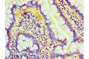 Immunohistochemistry of paraffin-embedded human small intestine tissue using ABIN7158764 at dilution of 1:100