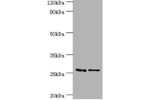 Western blot All lanes: GSTM4 antibody at 10 μg/mL Lane 1: Rat lung tissue Lane 2: MCF-7 whole cell lysate Secondary Goat polyclonal to rabbit IgG at 1/10000 dilution Predicted band size: 26, 23, 19 kDa Observed band size: 26 kDa (GSTM4 anticorps  (AA 1-218))