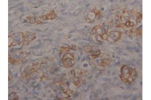 Detection of CK18 in Human Ovary Tissue using Polyclonal Antibody to Cytokeratin 18 (CK18)