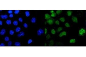 IF analysis of ZBTB7A using anti-ZBTB7A antibody (ABIN3044568).
