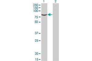 Western Blot analysis of ACVR2B expression in transfected 293T cell line by ACVR2B monoclonal antibody (M03), clone 1C11.
