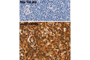 Immunohistochemistry (IHC) image for anti-Protein tyrosine Phosphatase, Receptor Type, C (PTPRC) (C-Term) antibody (ABIN6254210)