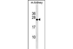 Western blot analysis in mouse kidney tissue lysates (35ug/lane). (GRPEL2 anticorps  (N-Term))