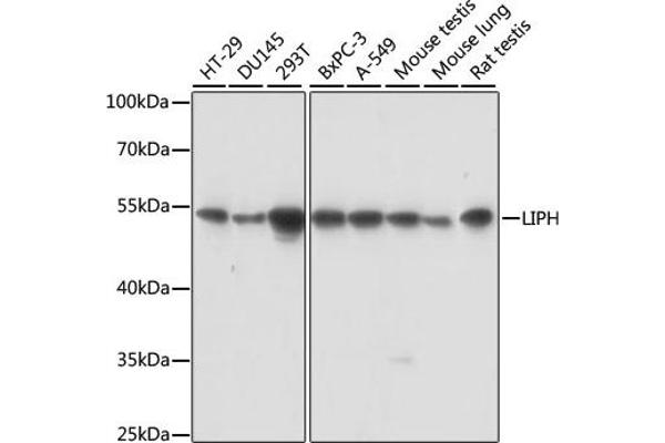 LIPH Antikörper  (AA 350-450)