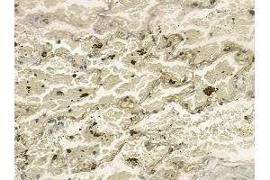 ABIN6258720 and ABIN6274746 at 1/100 staining human normal lung tissue by IHC-P. (MRPL9 anticorps  (C-Term))