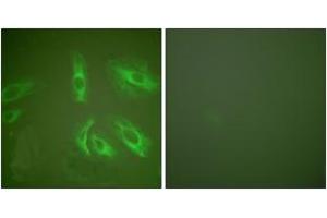 Immunofluorescence analysis of HeLa cells, using Gastrin Antibody. (Gastrin anticorps  (AA 52-101))