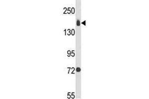 Western blot analysis of Integrin alpha 2 antibody and MDA-MB231 lysate (ITGA2 anticorps  (AA 1023-1049))